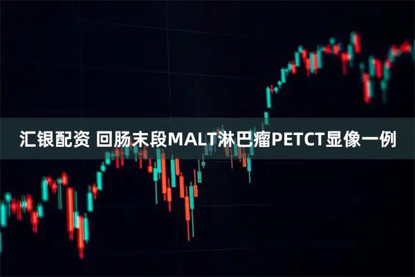 汇银配资 回肠末段MALT淋巴瘤PETCT显像一例