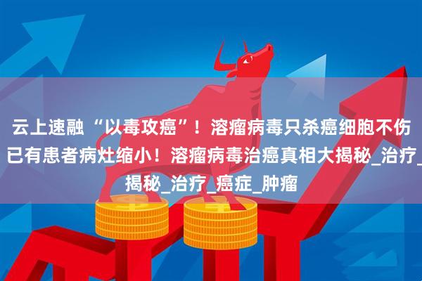 云上速融 “以毒攻癌”！溶瘤病毒只杀癌细胞不伤正常组织？已有患者病灶缩小！溶瘤病毒治癌真相大揭秘_治疗_癌症_肿瘤